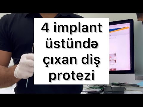 Alt çənədə protez