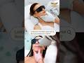 Looking for the best laser hair removal and botox treatment in delhi? #shorts #sharvaclinique #laser