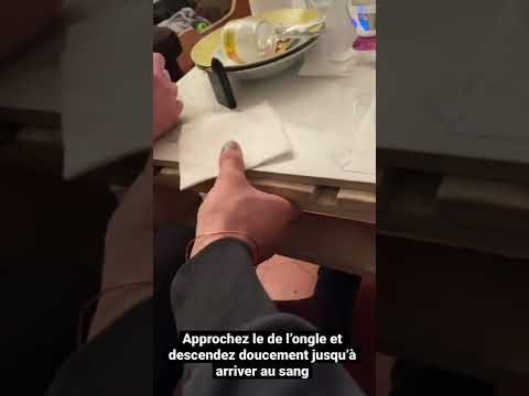 Vidéo: Comment enfoncer une aiguille chaude dans un ongle ?