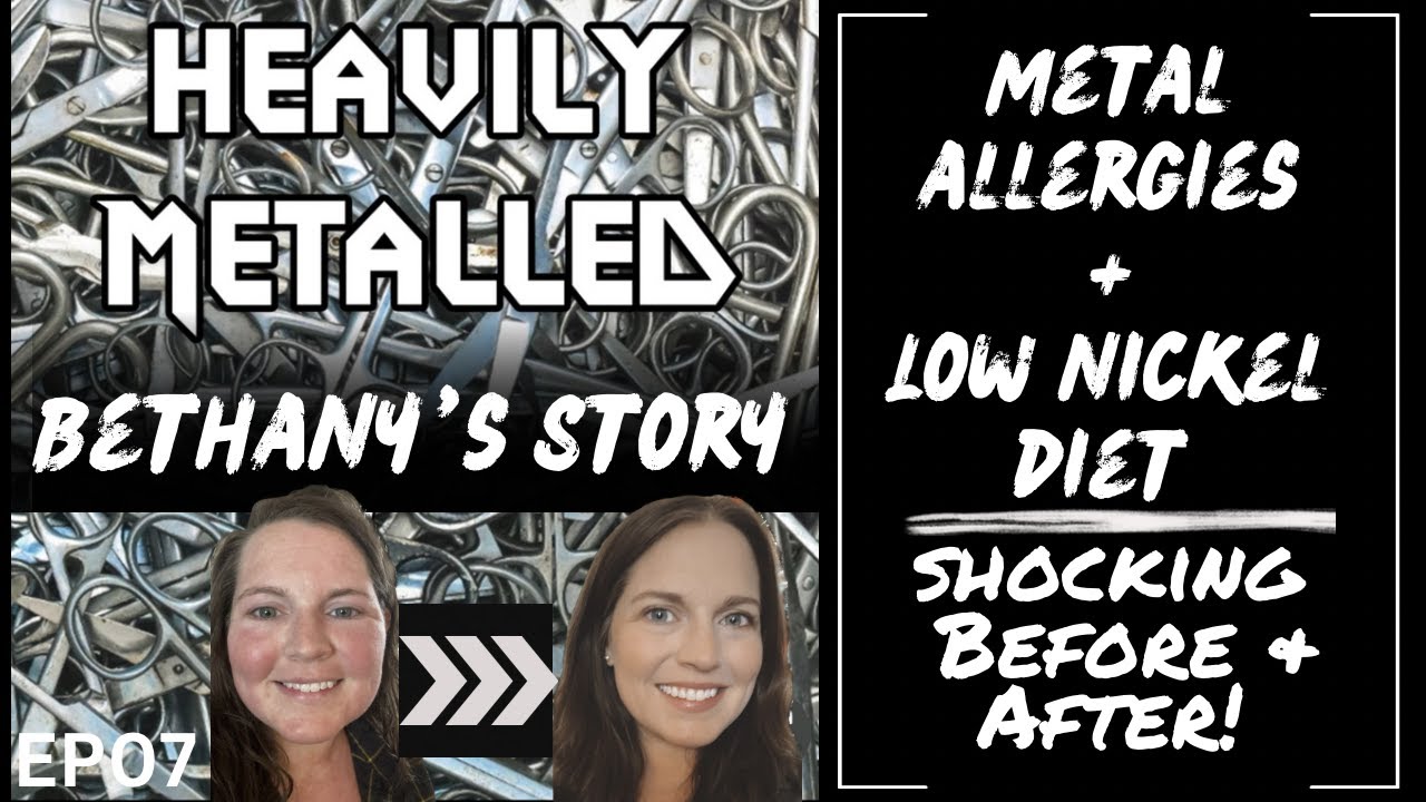 EP07 -  Metal Allergies & the Low-Nickel Diet: SHOCKING Before & After