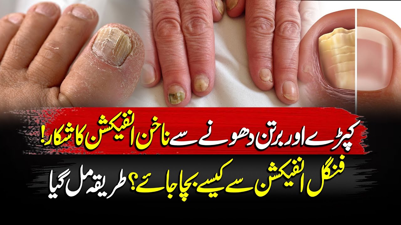 Nail Fungal Infection | Easy Tips to Keep Your Nails Healthy! | Good Morning Lahore | 26 Nov 2025