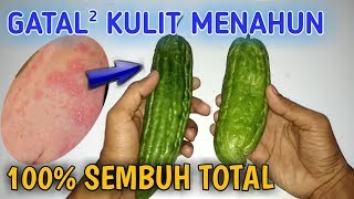Sangat Ampuh! Cara Mengobati Gatal Pada Kulit Yang Tak Kunjung Sembuh