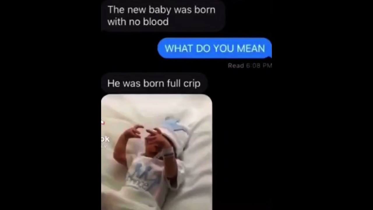Baby born full crip YouTube