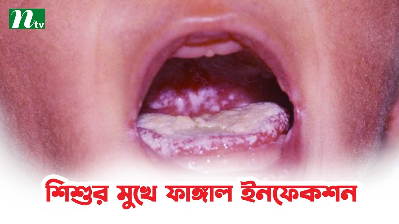 Ichkarida kamming haqida porno