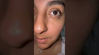 Itchy flaky Scalp help from JupiterHair #jupiterhair #ScalpCareTips #itchyscalp #shorts #flakeyscalp