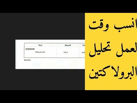 انسب وقت لعمل تحليل هرمون الحليب
