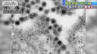 “風疹”全国的な大流行の恐れ　患者数1100人超に(18/10/16)
