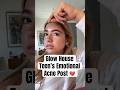 Glow House Teen's Emotional Acne Post #shorts #embreighcourtlyn #glowhouse