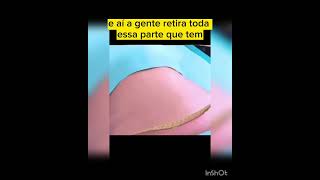 Como É Feita A Abdominoplastia