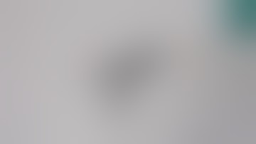 Chapter 18 - Flexible Robots in Endoscopic Surgery