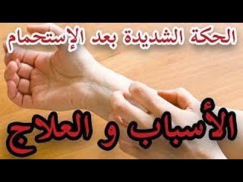 الهرش بعد الاستحمام