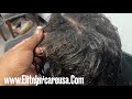 How to fix damaged hair| she is transitioning from relaxer to natural