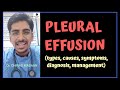 PLEURAL EFFUSION (types, causes, symptoms, diagnosis, management)