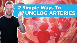 2 Simple Ways To Unclog And Decalcify Your Arteries