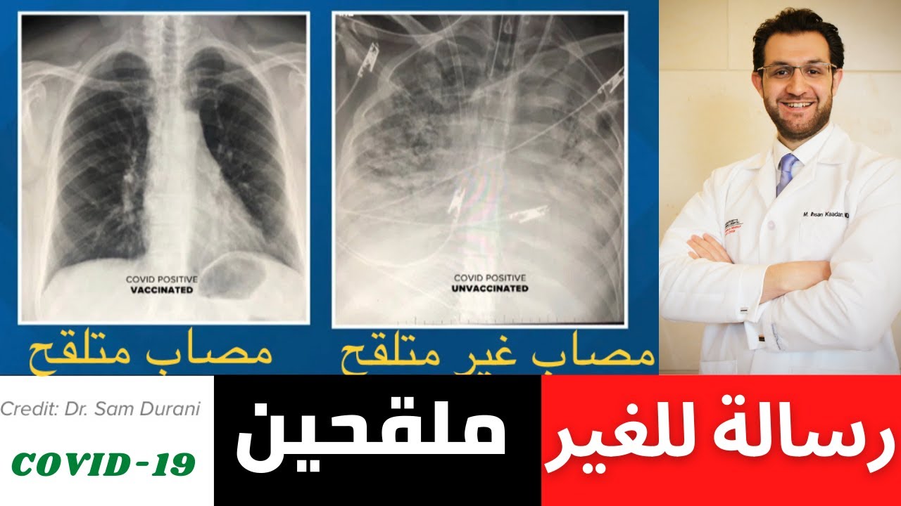 هذا ما حدث مع مريضي الرافض للقاح
