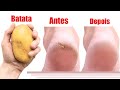 DESSA EU Não SABIA ! pés lisos com batata !