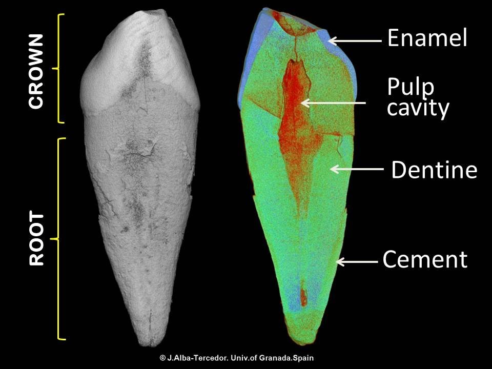 Micro-CT study of a human canine tooth (high definition) - YouTube