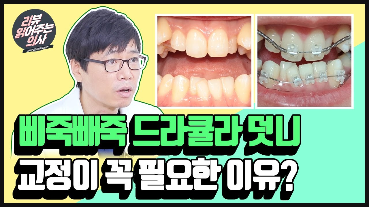 노원 아이디치과│삐죽빼죽 덧니🦷가 꼭 교정해야 하는 이유는?