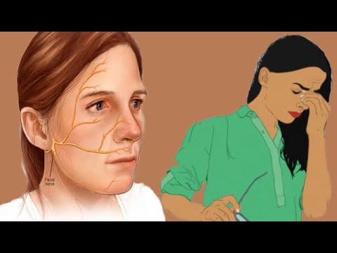 Facial Numbness And Anxiety Causes And Symptoms