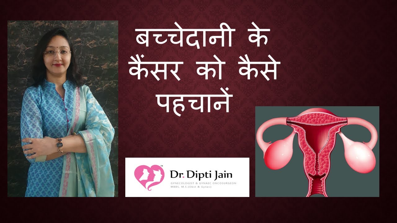 बच्चेदानी के कैंसर को कैसे पहचानें / SYMPTOMS OF UTERINE CANCER / गर्भाशय के कैंसर के लक्षण