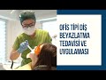 Diş Beyazlatma (Bleaching) Tedavisi | Ofis Tipi Uygulama