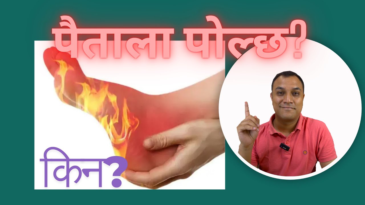 पैताला किन पोल्छ? 5 महत्वपूर्ण कारण -  Important reasons for burning sensation of feet - Dr. Diwakar