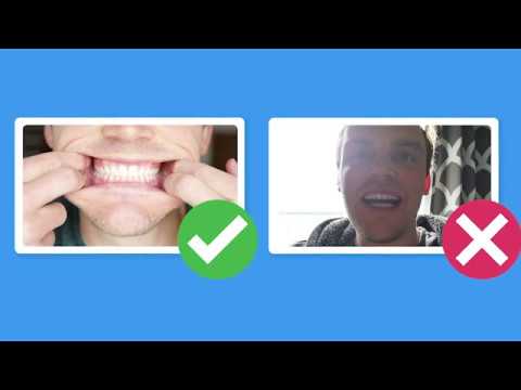 How to take pics of your teeth: Full video