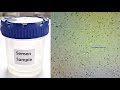 Sperm Motility and Viability Quiz