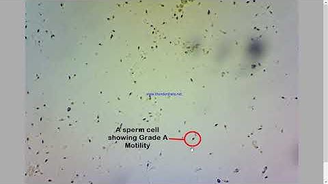Semen Analysis Test Lab | Sperm Motility Test