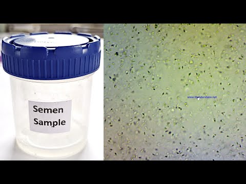 Video: Sædanalys: Sperm Count Test Procedure And Results