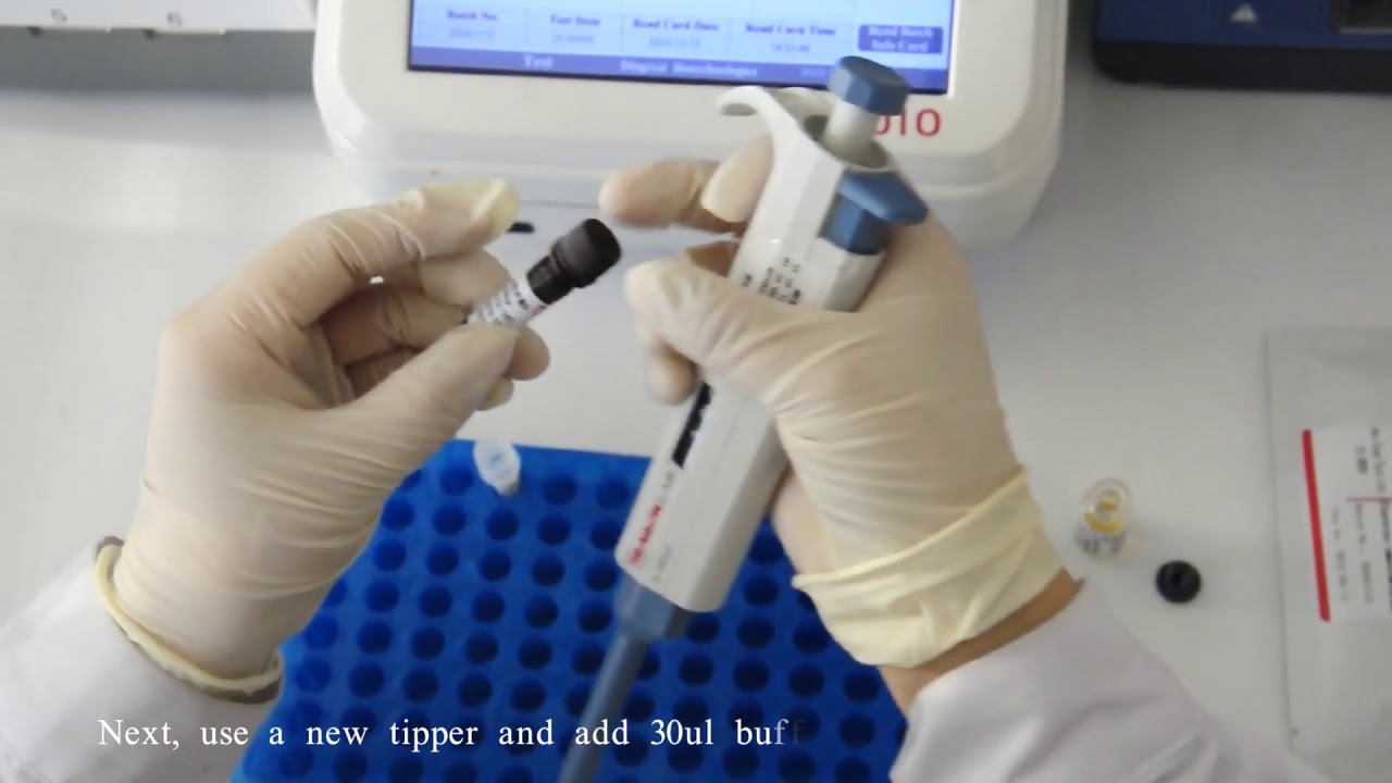 25Hydroxy Vitamin D Procedure video YouTube