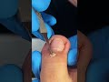 Satisfying nail cleaning process#nailcare #pedicure #satisfying #nailtech #oddlysatisfying #fyp