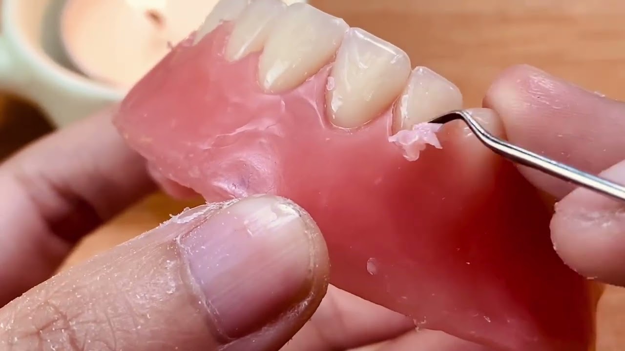 Thư xài dao gì làm sáp nướu? Hướng dẫn chi tiết sáp nướu cơ bản cho người mới. 