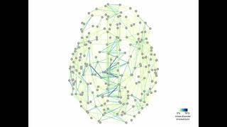 OHBM 2018 | Oral Session | Siemon de Lange | Cross-disorder connectome examination reveals general…