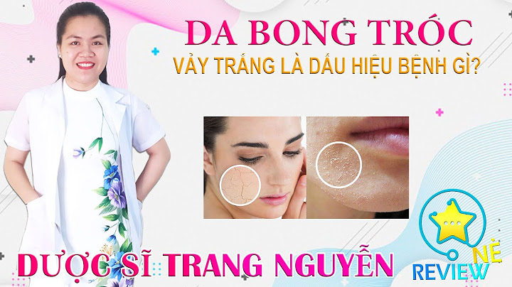 Nguyên nhân da mặt bị bong tróc