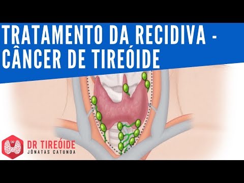 🔴 Tratamento da
