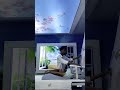 MRCP procedure Kaisa hota Hai