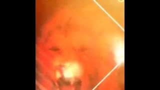 Dakka Dakka Darkkey Mix RAPPERz Co Tamil Mixz