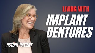 Can You Eat Whatever You Want with Dentures?