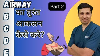 गंभीर मरीज में airway का आकलन कैसे करे ? Airway assessment and management