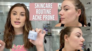 MY SKINCARE ROUTINE FOR ACNE PRONE SKIN