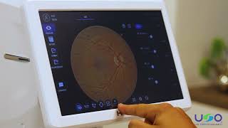 Fundus - Optical Coherence Tomography with Fundus HOCT Huvitz - US Ophthalmic