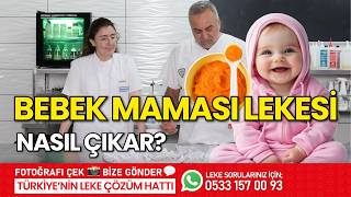 Bebek Mamasi Lekesi̇ Nasil Çikar? Leke Kütüphanesi̇