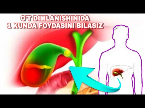 Video: Gable tomlari: qurilma, o'rnatish usullari, hisoblash, dizayn, fotosurat