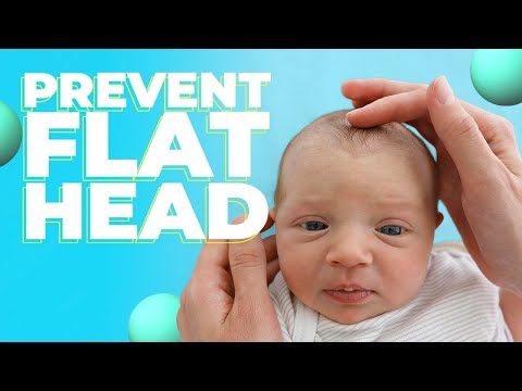 Flat Head - Tips to Avoid It (and what to do if you notice a flat spot)