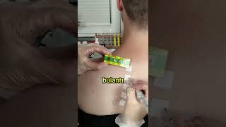 Küflü Yemek Yersem Ne Olur