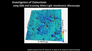 [Life] Investigation of Osteoclasts using SEM and Scanning White Light Interference Microscope