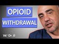 Opioid Withdrawal Timeline and Symptoms: The Painful Truth! | Dr. B