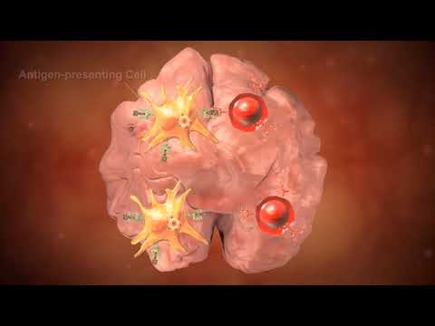 CD8 T- ლიმფოციტების მიერ სიმსივნური უჯრედების განადგურების პროცესი