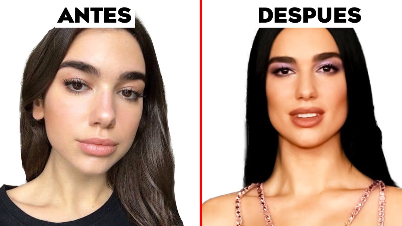 Dua Lipa y su nuevo rostro ¿Qué cirugías estéticas se hizo? YouTube Dua Lipa y su nuevo rostro ¿Qué cirugías estéticas se hizo? YouTube